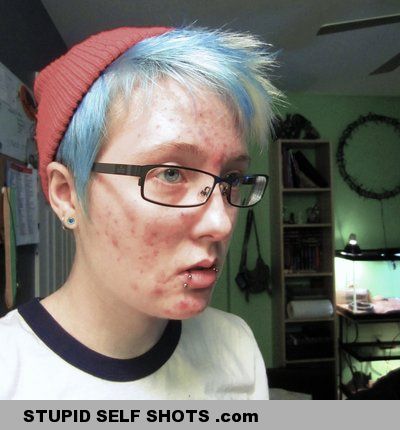 Acne and Blue Hair Self Shot