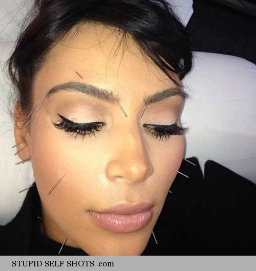 Kim Kardashian acupuncture, selfie